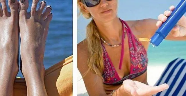 photo peau bronzée ou teint de porceleine, à chacun son résultat à la fin de l'été ! &copy; reuters/fotolia