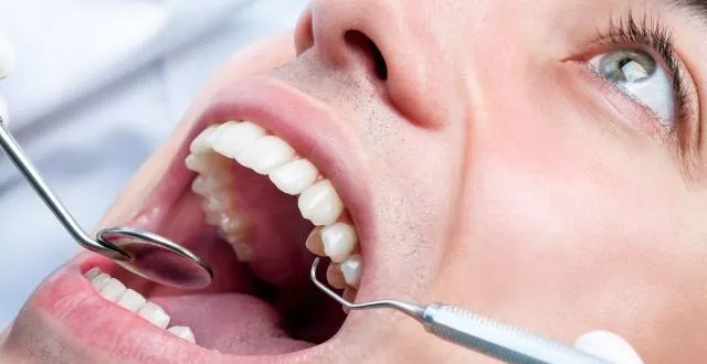 photo les joueurs anglais auraient trop de caries. &copy; photo : ouest-france.