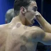 photo mais quels sont ces mystérieux points violets sur le corps de michael phelps ?