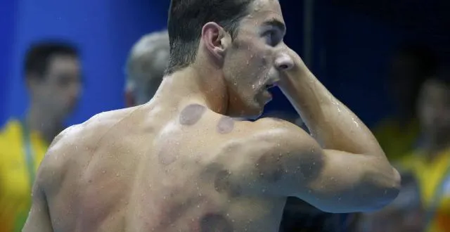 photo mais quels sont ces mystérieux points violets sur le corps de michael phelps ? &copy; reuters