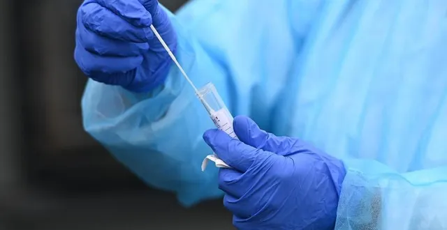 photo  les taux d’incidence et de positivité du covid-19 continuent d’augmenter.  &copy;  archivesouest-france 