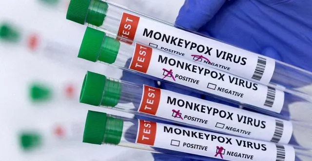 photo  tests de variole du singe, « monkeypox virus » en anglais.  &copy;  reuters 