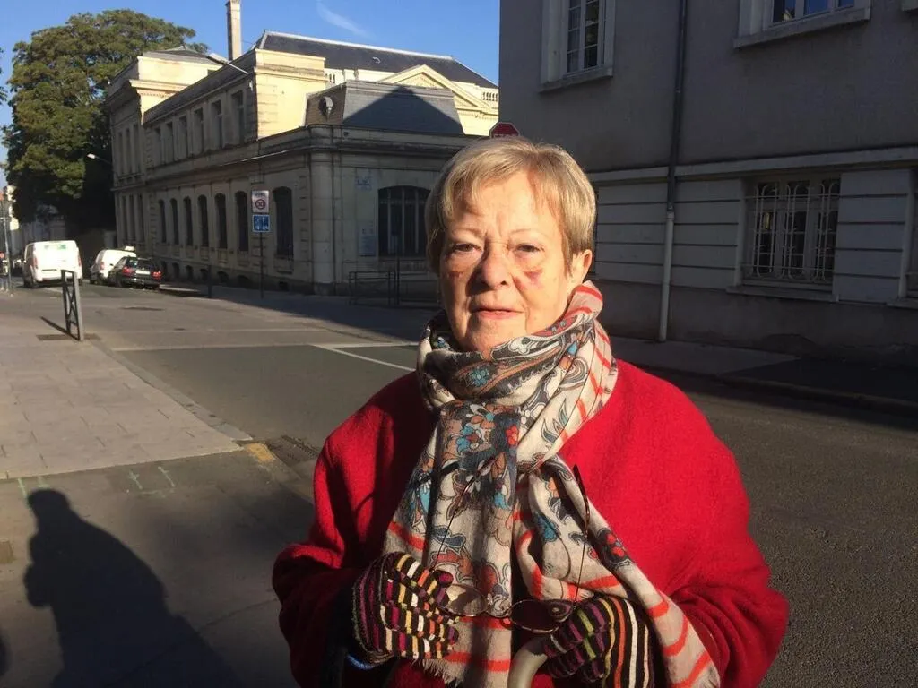 Visage tuméfié, côte cassée A 86 ans, elle est renversée par une