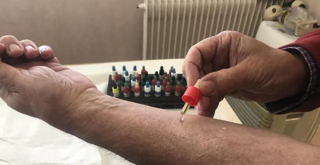 photo  les tests cutanés réalisés par un allergologue déterminent les allergies en fonction de la réaction provoquée.  &copy;  co – camille rivieccio 