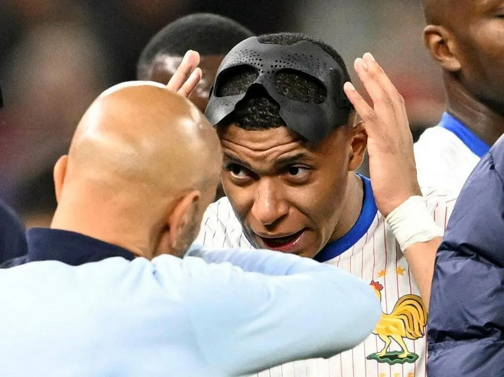 Kylian Mbappé sera bientôt fixé sur une éventuelle opération de son nez
