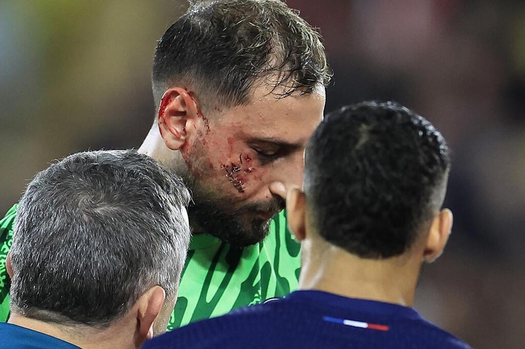 Monaco - PSG. Victime D’un « Traumatisme Facial », Gianluigi Donnarumma ...