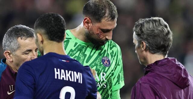 photo  sévèrement touché au visage en ligue 1, déjà face à monaco, gianluigi donnarumma est de retour dans le groupe du psg pour le trophée des champions.  ©  photo : valery hache / afp 