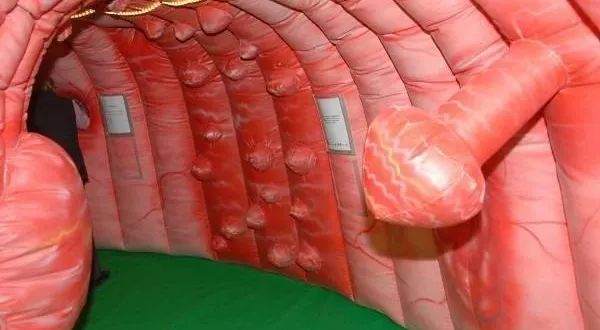 photo  plusieurs animations sont organisées ce mois-ci pour sensibiliser les personnes de plus de 50 ans au problème du cancer colorectal. une structure gonflable représentant un côlon géant sera exposée les 24 et 28 mars 2025 au mans puis à la ferté-bernard.  &copy;  photo archives le courrier de l’ouest 