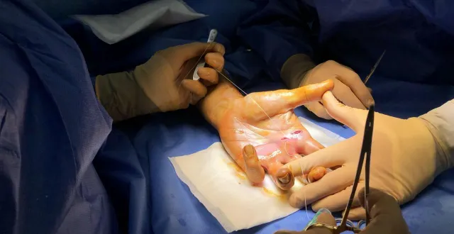 photo  le centre de la main d’angers (maine-et-loire) demande en justice 3 millions d’euros à l’agence régionale de santé des pays de la loire.  &copy;  ouest-france 