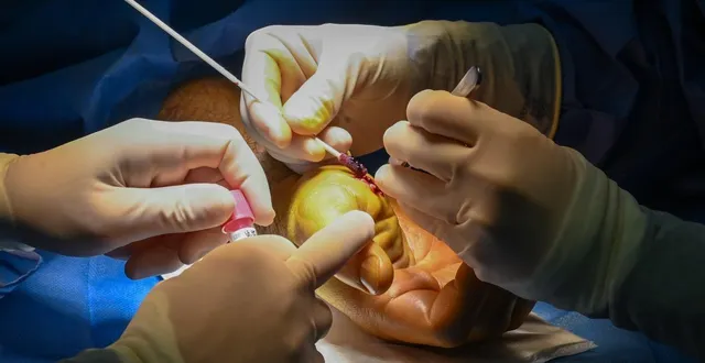 photo  trélazé, rue de la foucaudière, 29 décembre 2025. ce patient a été opéré, la main entaillée en ouvrant une huître. avant de suturer la plaie, le chirurgien s’assure qu’aucun débris de coquille ne reste dans l’organe et que les tendons, nerfs et artères n’ont pas été touchés.  &copy;  co - laurent combet 