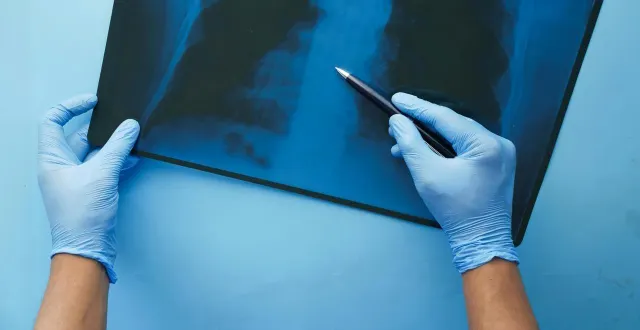 photo  un tournevis dentaire a été découvert par des médecins dans les bronches d’une jeune italienne souffrant de toux persistante et de fortes douleurs thoraciques. photo d’illustration.  &copy;  pexels 