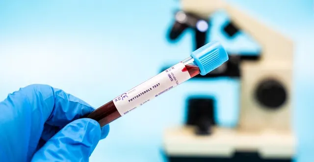 photo  la plupart des tests proposés sont des bilans classiques, dosages des taux de fer, de vitamines…  &copy;  afp 