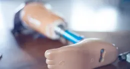 Info insolite  la prothèse a refait surface dix mois après avoir disparu. 