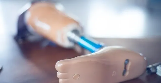 photo  la prothèse a refait surface dix mois après avoir disparu.  &copy;  photo d’illustration : angkhan / istock 