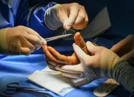 photo  trélazé, décembre 2025. les praticiens du centre de la main demandent la reconnaissance de cet établissement privé comme plateau technique spécialisé à accès direct pour bénéficier de subventions supplémentaires. 