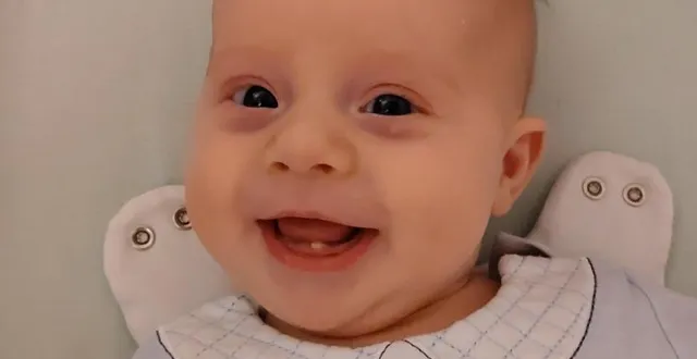 photo  le 12 novembre 2025, à la clinique de keraudren à brest, elouenn a pointé le bout de son nez, mais aussi… d’une dent !  &copy;  ouest-france 